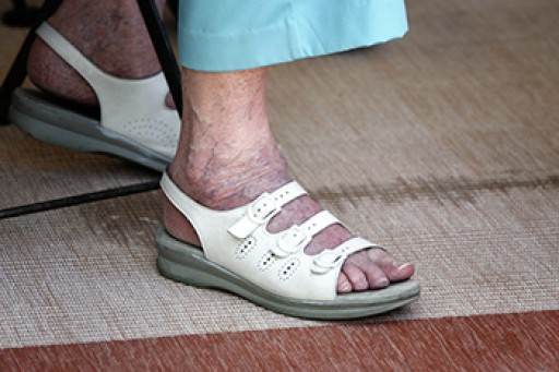 How Aging Can Affect Your Feet